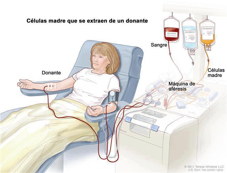 aferesis2